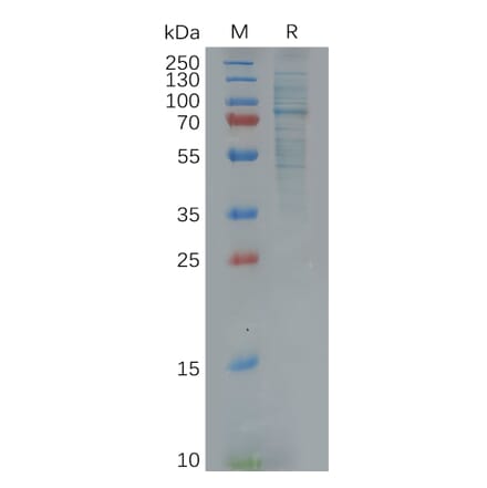 SDS-PAGE - Recombinant Human GAS 6 Protein (6×His Tag) (A318123) - Antibodies.com