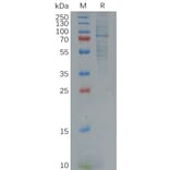 SDS-PAGE - Recombinant Human GAS 6 Protein (6×His Tag) (A318123) - Antibodies.com