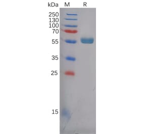 SDS-PAGE - Recombinant Human Frizzled 4 Protein (Fc Tag) (A318124) - Antibodies.com