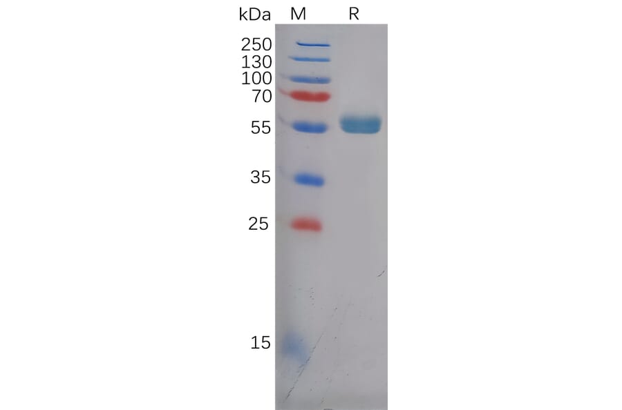 SDS-PAGE - Recombinant Human Frizzled 4 Protein (Fc Tag) (A318124) - Antibodies.com