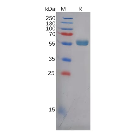 SDS-PAGE - Recombinant Human Frizzled 4 Protein (Fc Tag) (A318124) - Antibodies.com