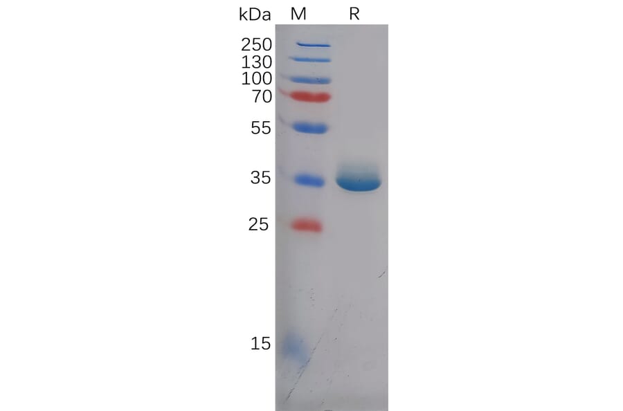 SDS-PAGE - Recombinant Human Epiregulin Protein (Fc Tag) (A318125) - Antibodies.com