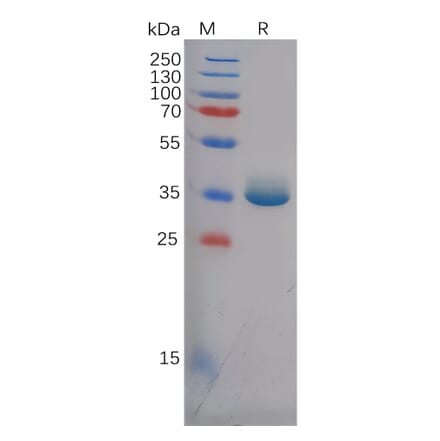 SDS-PAGE - Recombinant Human Epiregulin Protein (Fc Tag) (A318125) - Antibodies.com