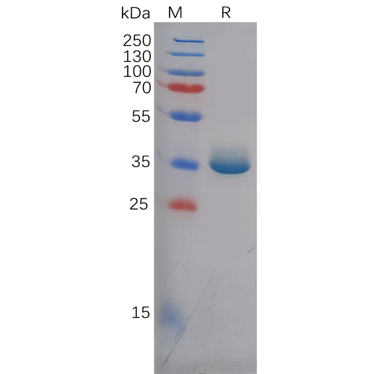 SDS-PAGE - Recombinant Human Epiregulin Protein (Fc Tag) (A318125) - Antibodies.com