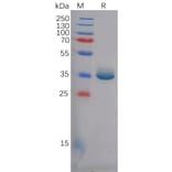 SDS-PAGE - Recombinant Human Epiregulin Protein (Fc Tag) (A318125) - Antibodies.com