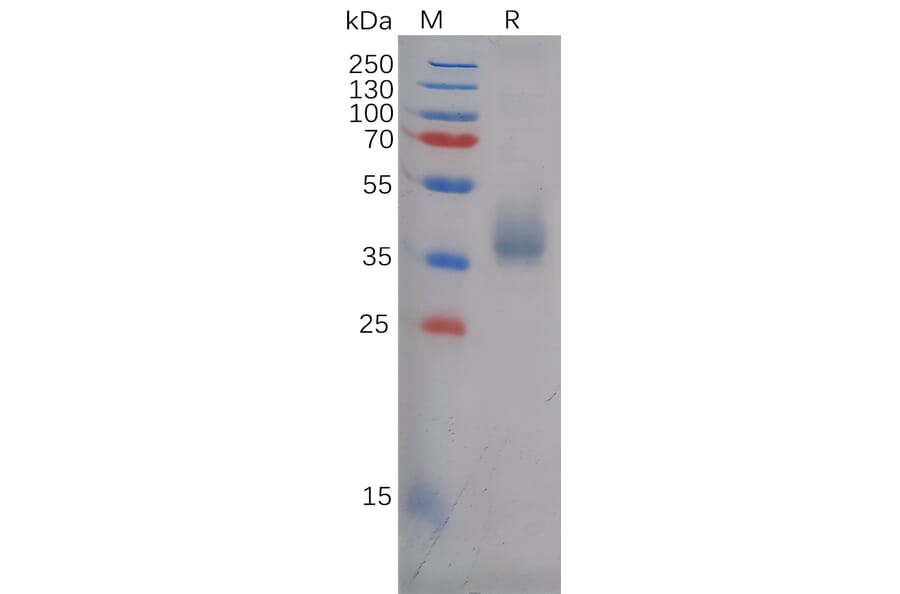 SDS-PAGE - Recombinant Human TEM8/ATR Protein (6×His Tag) (A318126) - Antibodies.com