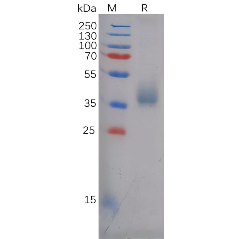 SDS-PAGE - Recombinant Human TEM8/ATR Protein (6×His Tag) (A318126) - Antibodies.com
