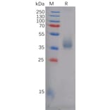 SDS-PAGE - Recombinant Human TEM8/ATR Protein (6×His Tag) (A318126) - Antibodies.com