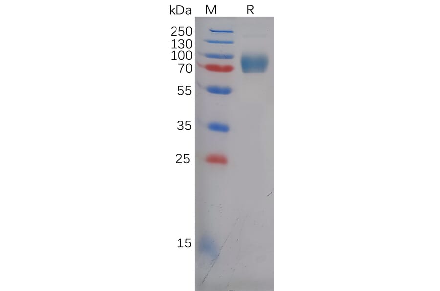 SDS-PAGE - Recombinant Human Eph Receptor A5/BSK Protein (6×His Tag) (A318127) - Antibodies.com