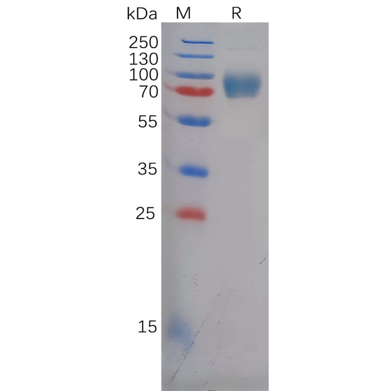 SDS-PAGE - Recombinant Human Eph Receptor A5/BSK Protein (6×His Tag) (A318127) - Antibodies.com