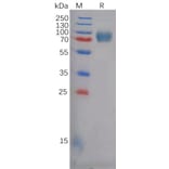 SDS-PAGE - Recombinant Human Eph Receptor A5/BSK Protein (6×His Tag) (A318127) - Antibodies.com