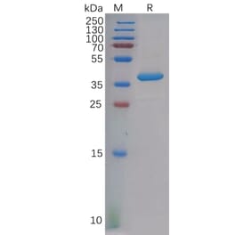 SDS-PAGE - Recombinant Human PF4 Protein (Fc Tag) (A318130) - Antibodies.com