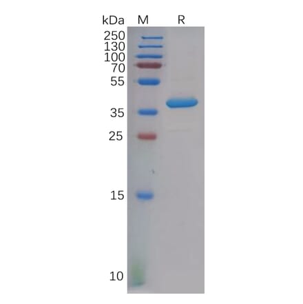 SDS-PAGE - Recombinant Human PF4 Protein (Fc Tag) (A318130) - Antibodies.com