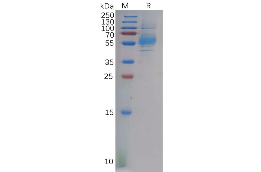 SDS-PAGE - Recombinant Human CLEC9A Protein (Fc Tag) (A318131) - Antibodies.com