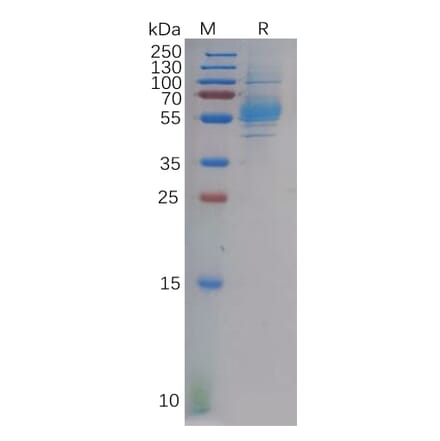 SDS-PAGE - Recombinant Human CLEC9A Protein (Fc Tag) (A318131) - Antibodies.com
