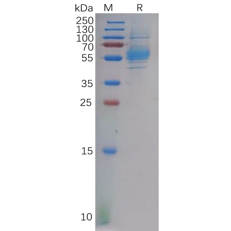 SDS-PAGE - Recombinant Human CLEC9A Protein (Fc Tag) (A318131) - Antibodies.com