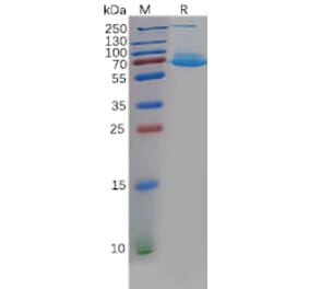 SDS-PAGE - Recombinant Human CLEC1 Protein (Fc Tag) (A318132) - Antibodies.com