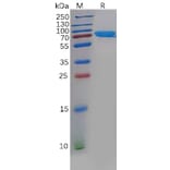 SDS-PAGE - Recombinant Human CHODL Protein (Fc Tag) (A318133) - Antibodies.com