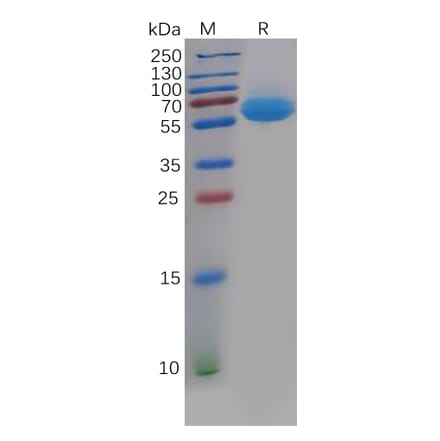 SDS-PAGE - Recombinant Human CD69 Protein (Fc Tag) (A318135) - Antibodies.com