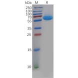 SDS-PAGE - Recombinant Human CD69 Protein (Fc Tag) (A318135) - Antibodies.com