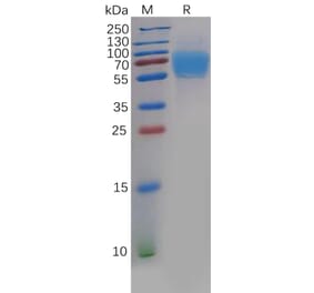 SDS-PAGE - Recombinant Human CRTAM Protein (6×His Tag) (A318136) - Antibodies.com