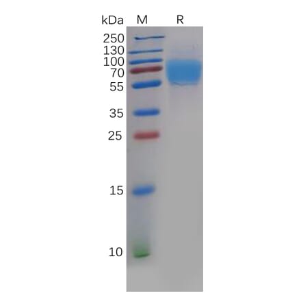 SDS-PAGE - Recombinant Human CRTAM Protein (6×His Tag) (A318136) - Antibodies.com