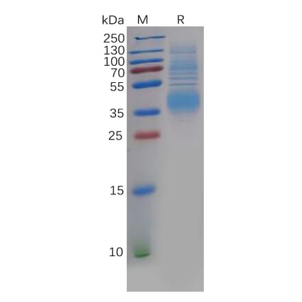 SDS-PAGE - Recombinant Human Clusterin Protein (6×His Tag) (A318137) - Antibodies.com