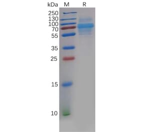 SDS-PAGE - Recombinant Human CLEC14A Protein (6×His Tag) (A318138) - Antibodies.com