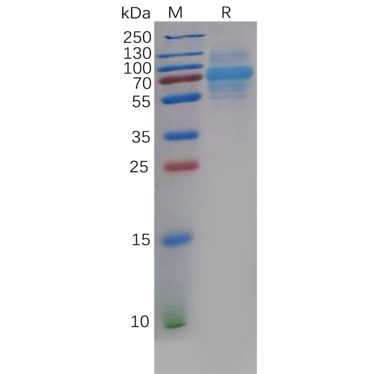 SDS-PAGE - Recombinant Human CLEC14A Protein (6×His Tag) (A318138) - Antibodies.com
