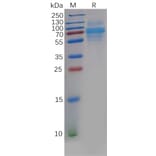 SDS-PAGE - Recombinant Human CLEC14A Protein (6×His Tag) (A318138) - Antibodies.com