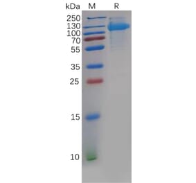 SDS-PAGE - Recombinant Human CDCP1 Protein (6×His Tag) (A318139) - Antibodies.com