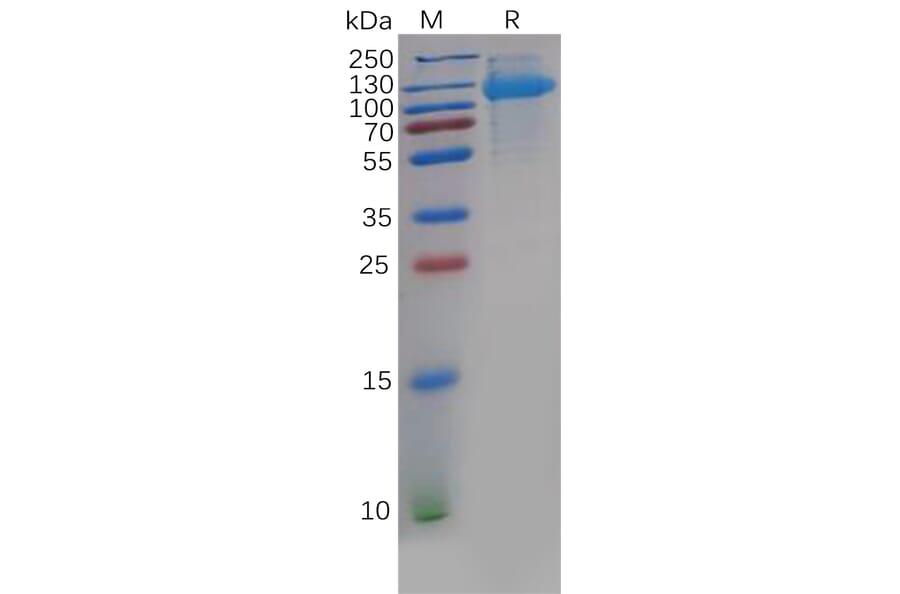 SDS-PAGE - Recombinant Human CDCP1 Protein (6×His Tag) (A318139) - Antibodies.com