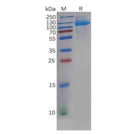 SDS-PAGE - Recombinant Human CDCP1 Protein (6×His Tag) (A318139) - Antibodies.com