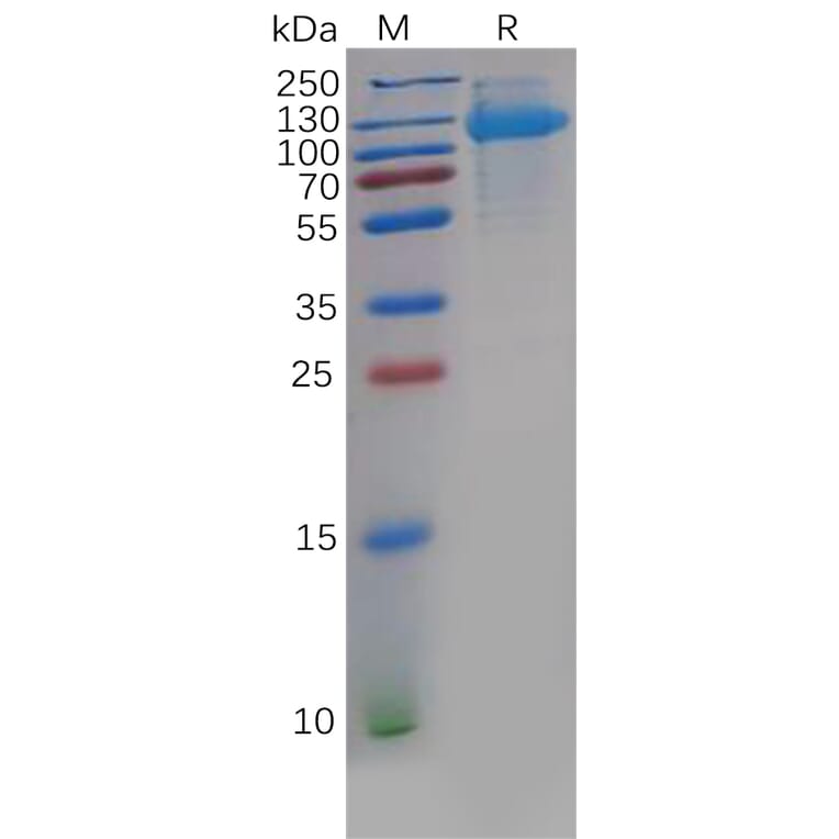 SDS-PAGE - Recombinant Human CDCP1 Protein (6×His Tag) (A318139) - Antibodies.com