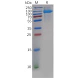 SDS-PAGE - Recombinant Human CDCP1 Protein (6×His Tag) (A318139) - Antibodies.com