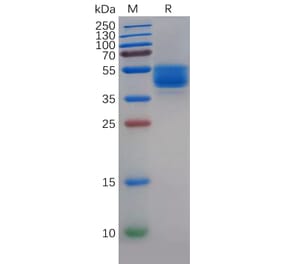 SDS-PAGE - Recombinant Human P Glycoprotein Protein (Fc Tag) (A318140) - Antibodies.com
