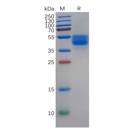 SDS-PAGE - Recombinant Human P Glycoprotein Protein (Fc Tag) (A318140) - Antibodies.com