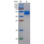 SDS-PAGE - Recombinant Human P Glycoprotein Protein (Fc Tag) (A318140) - Antibodies.com