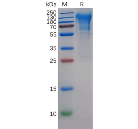 SDS-PAGE - Recombinant Human CD68 Protein (6×His Tag) (A318141) - Antibodies.com