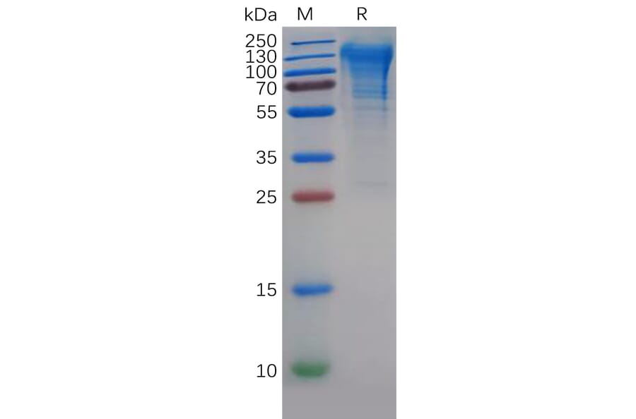 SDS-PAGE - Recombinant Human CD68 Protein (6×His Tag) (A318141) - Antibodies.com