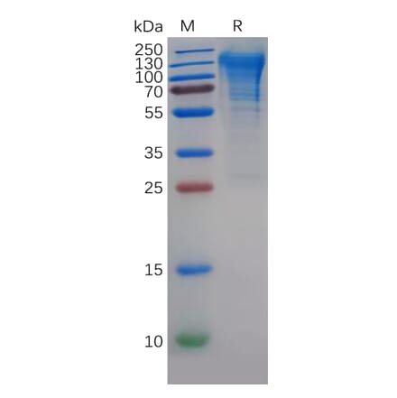 SDS-PAGE - Recombinant Human CD68 Protein (6×His Tag) (A318141) - Antibodies.com