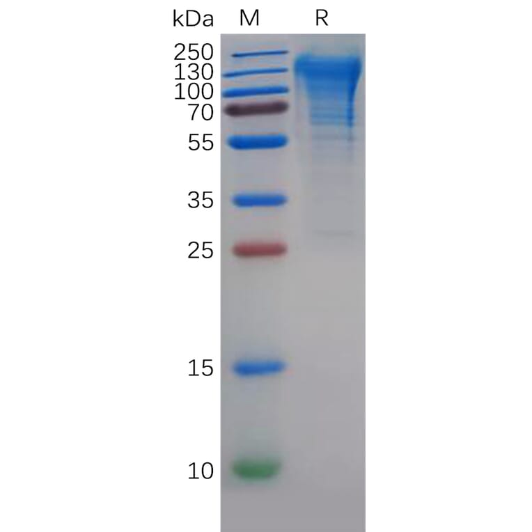 SDS-PAGE - Recombinant Human CD68 Protein (6×His Tag) (A318141) - Antibodies.com