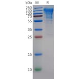 SDS-PAGE - Recombinant Human CD68 Protein (6×His Tag) (A318141) - Antibodies.com