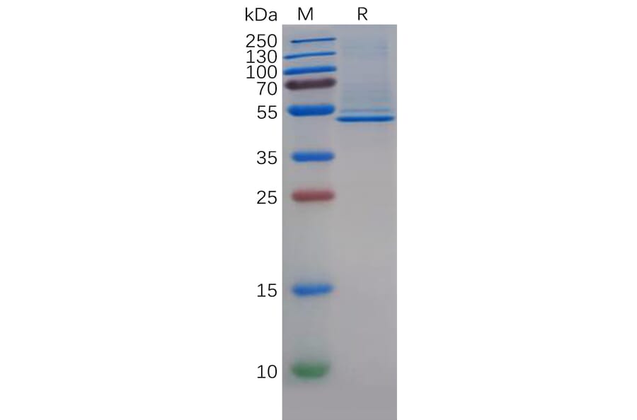 SDS-PAGE - Recombinant Human CD5L/CT-2 Protein (6×His Tag) (A318142) - Antibodies.com