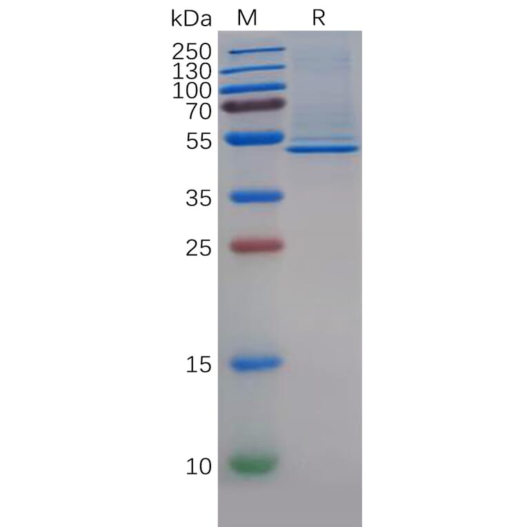 SDS-PAGE - Recombinant Human CD5L/CT-2 Protein (6×His Tag) (A318142) - Antibodies.com