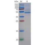 SDS-PAGE - Recombinant Human CD5L/CT-2 Protein (6×His Tag) (A318142) - Antibodies.com