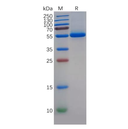 SDS-PAGE - Recombinant Human uPA Protein (6×His Tag) (A318143) - Antibodies.com