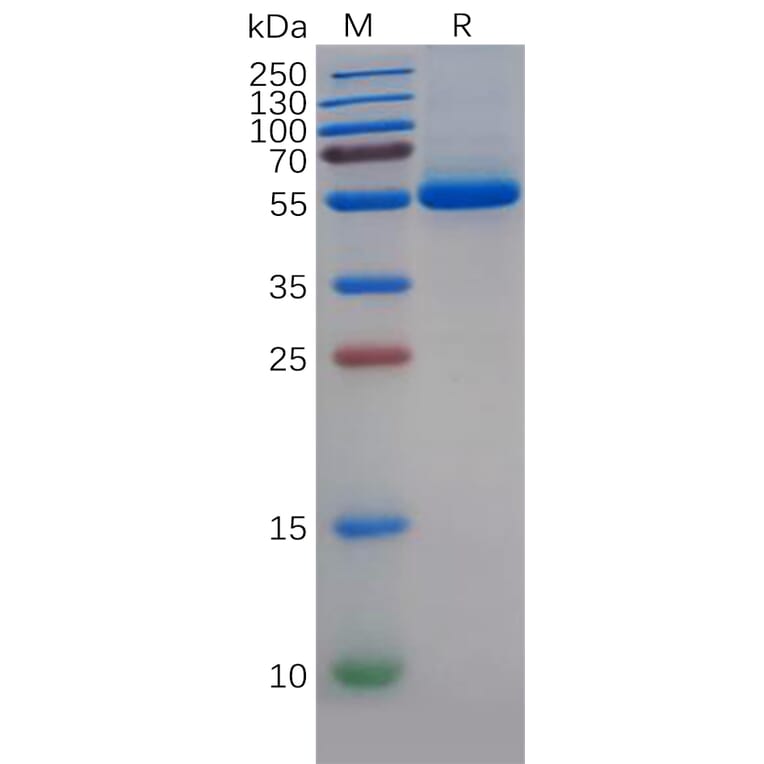 SDS-PAGE - Recombinant Human uPA Protein (6×His Tag) (A318143) - Antibodies.com