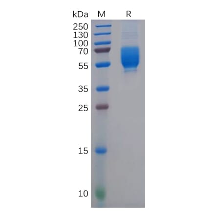 SDS-PAGE - Recombinant Human CD62L Protein (6×His Tag) (A318144) - Antibodies.com