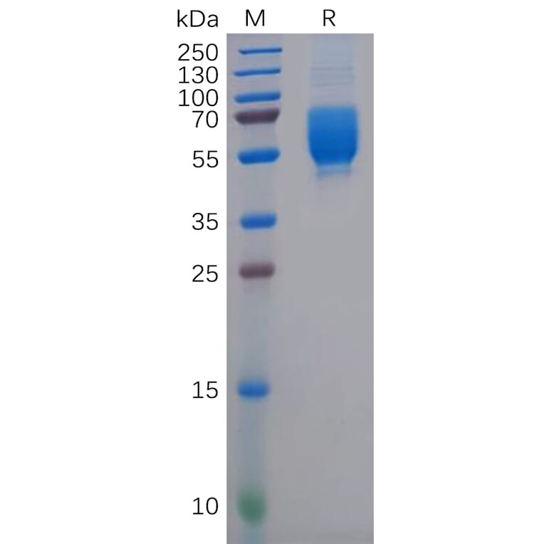 SDS-PAGE - Recombinant Human CD62L Protein (6×His Tag) (A318144) - Antibodies.com
